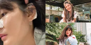 Menyesal Lakukan Oplas, 8 Potret Kondisi Angela Lee Usai Hidung Barunya Miring - Implan Sampai Tembus ke Kulit