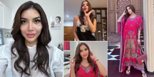 Millen Cyrus Diduga Oplas 'Ganti Kepala' Seperti Lucinta Luna, Intip Transformasinya Setelah Pasang Filler Bak Angelina Jolie
