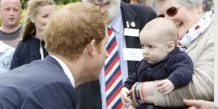 Pangeran Harry Mulai Mengalami Gejala Kebotakan