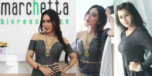 Pasca Perawatan Listrik, Delia Alena & Resty Sayyong Makin Cantik