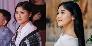 Perutnya Sempat Ramai Disorot, 8 Potret Erina Gudono yang Pernah Dikira Hamil oleh Netizen - Pilih Tunda Momongan Demi Hal Mulia