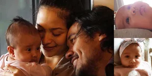 Pesona Teduh Baby Surinala Buah Hati Chicco - Putri Marino