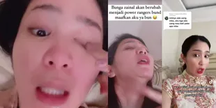 Potret Bunga Zainal Disebut Lakukan Operasi Plastik, Berang Sampai Minta Dibayar Jika Bisa Buktikan