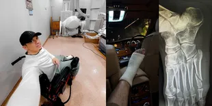 Potret Irwansyah Alami Patah Tulang Kaki, Kini Harus Digips - Tetap Bersyukur Karena Jadi Punya Waktu Untuk Anak