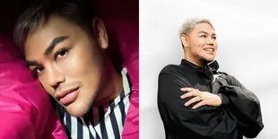 Potret Ivan Gunawan Pamer Bibir Baru Usai Lakukan Filler, Disebut Mirip Nikita Mirzani Versi Lelaki