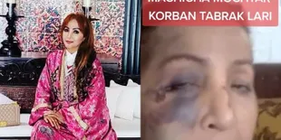 Potret Machica Mochtar Setelah Jadi Korban Tabrak Lari Sopir Angkot, Wajah Lebam-Lebam Membiru