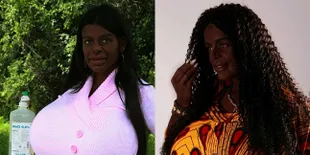 Potret Martina, Wanita yang Ingin Punya Dada Sebesar Kapal Titanic