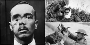 Potret Memilukan Perang Dunia I & II, Mengharukan Penuh Emosi