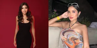 Potret Millendaru Tunjukkan Bekas Lebam di Area Payudara, Dituding Netizen Habis Berbuat Tidak Senonoh 