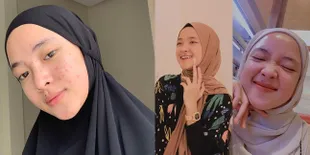 Potret Nissa Sabyan Kala Pamer Bareface, Sempat Jerawatan Parah - Kini Kinclong dan Panen Pujian Cantik
