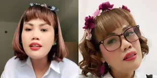 Potret Penampilan Terbaru Elly Sugigi, Giginya yang Makin Lurus Rapi - Makin Imut Saat Berponi
