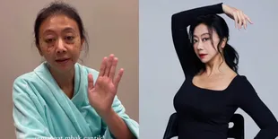 Potret Proses Operasi Plastik Asri Welas di Korea Selatan, Hasilnya Luar Biasa