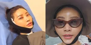 Potret Sarwendah Setelah Jalani Operasi Plastik di Korea, Minum Pakai Suntikan - Pede Jalan dengan Muka Lebam