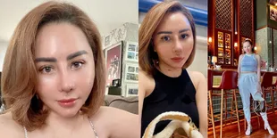 Potret Terbaru Femmy Permatasari Usai Oplas di Korea, Ngaku Masih Sakit Karena Ambil Tulang Iga Untuk Bikin Mancung