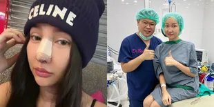 Potret Terbaru Lucinta Luna Usai Oplas Hidung Lagi, Kini Diperban dan Terlihat Bengkak - Wajahnya Disebut Aneh Oleh Netizen