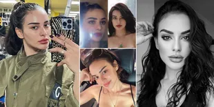 Potret Terbaru Nora Alexandra yang Dituduh Oplas, Wajahnya Disebut Aneh dan Berbeda oleh Suami Sendiri