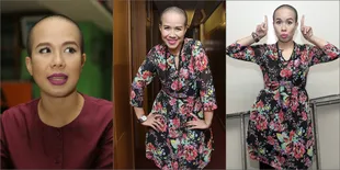 Potret TJ Botak Seperti Tuyul, Masih Cantik Nggak Sih?