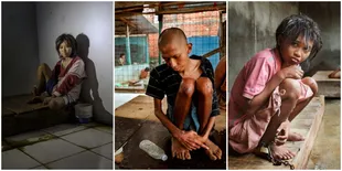 Potret Tradisi Pasung Pasien Sakit Jiwa di Indonesia, Miris!