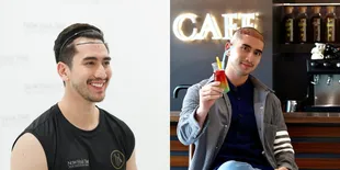 Potret Verrell Bramasta Jalani Transplantasi Rambut, Disebut Netizen Botak Tapi Tetap Ganteng