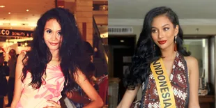 Ramai Dihujat karena Operasi Plastik, Ini 8 Potret Aurra Kharishma Dulu dan Kini yang Jauh Berbeda - Ivan Gunawan: Oplasnya Nggak Endorse! 