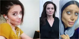 Sahar Tabar, Wanita 19 Tahun Yang Oplas 50 Kali Demi Mirip Jolie
