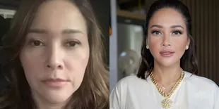Sederet Seleb Indonesia yang Memilih Perawatan Botox, Bikin Kulit Kencang dan Penampilan Awet Muda Banget