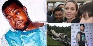 Selain Selena Gomez, Artis Ini Juga Jalani Operasi Demi Hidup