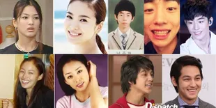 Seleb Korea Yang Makin Cantik & Ganteng Setelah Memperbaiki Gigi