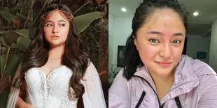 Sempat Operasi Tumor, 8 Potret Marshanda yang Kini Berjuang Melawan Ginjal dan Inflamasi Kronis - Akui Berhutang Demi Sembuh