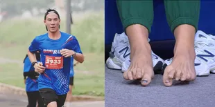 Sering Lomba Marathon, Daniel Mananta Tunjuk Kuku Jempol Kakinya yang Lepas Hingga Menghitam - Desta Sampai Kaget