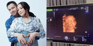 Tersenyum di Dalam Janin, Deretan Foto USG Calon Anak Nagita Slavina dan Raffi Ahmad yang Sebentar Lagi Lahir: Dibanjiri Doa Baik Dari Netizen