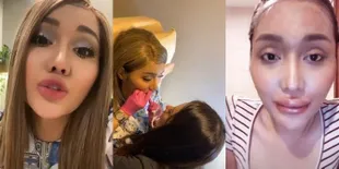 Transformasi Bibir Lucinta Luna Sebelum dan Sesudah Difiller, Mengaku Mirip Kylie Jenner