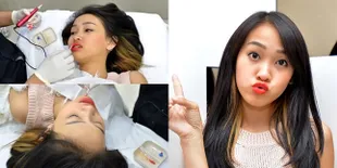 Transformasi Felly Chibi Before & After Sulam Bibir, Cantik Abis!