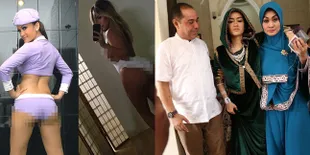 Transformasi Jupe, Dulu Seksi Bak Kim K Kini Kurus Karena Kanker
