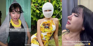 Transformasi Lucinta Luna dari Belum Mengenal Oplas Sampai Dipermak Berkali-Kali Hingga Disebut Mirip Barbie dan BLACKPINK