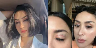 Ubah Kelopak Mata Jadi Ala Korea, 8 Potret Selvi Kitty Banjir Cibiran dari Netizen - Disebut Aneh dan Lebih Cantik Sebelumnya