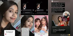 Unggah Foto Tanpa Makeup & Filter, Brisia Jodie Sakit Hati Karena Dibully Netizen - Banjir Dukungan dari Rekan Sesama Artis