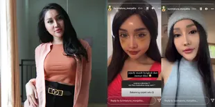 Usai Unboxing, Ini Potret Wajah Lucinta Luna yang Masih Bengkak dan Memar - Jadi Lebih Cantik dari Sebelumnya Hidungnya Jadi Sorotan