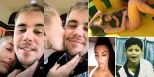 Weekly Hot: Foto Mesra Justin Bieber - Psoriasis Kim Kardashian