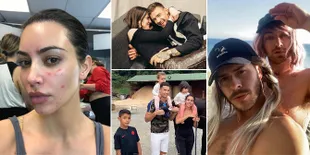 Weekly Hot IG: Sam Smith Pakai Wig Pink - Psoriasis di Wajah Kim Kardashian