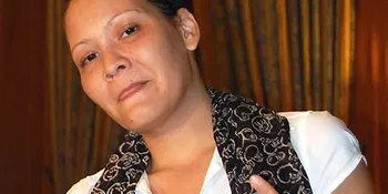 Kena Tumor, Melanie Subono Tetap Cuek