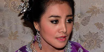 Cici: Kalau Epilepsi, Saya Nggak Mungkin Nyanyi