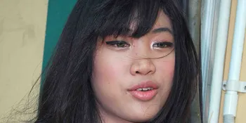 Gedung Tanah Abang Roboh, Widy Vierra Tak Kaget