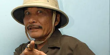 Kecelakaan, Putri H. Bolot Jalani Operasi Ganti Rahang