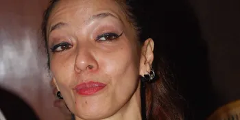 Vicky Burky Jalani Terapi Air Seni