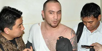 Gary Iskak Di-BAP Polisi