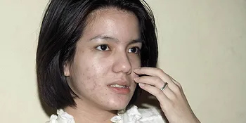 Shock Ayah Roger Meninggal, Maag Sheila Kambuh