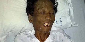 Diet Cholik Berujung Derita