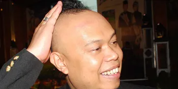 Edwin: Muka Gue Jadi Tampak Badung