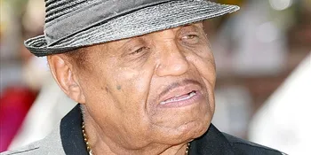 Michael Jackson Tak Jujur Soal Operasi Plastik